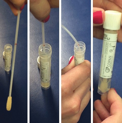 corneal culture