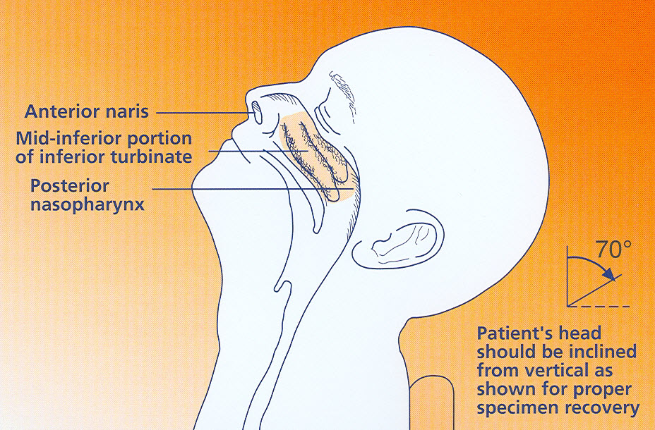 NP_Swab_Diagram2