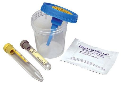 BD_Vacutainer_Urine_Collection_Kit_with_Screw_Cap_Cup_1200x1200